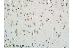 Formalin-fixed and paraffin embedded rat brain tissue labeled with Anti-LC3B/MAP LC3? (MAP1LC3A/B 抗体  (AA 21-121))