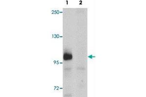 Western blot analysis of ZC3HAV1 in HeLa cell lysate with ZC3HAV1 polyclonal antibody  at 1ug/mL in (1) the absence and (2) the presence of blocking peptide. (ZC3HAV1 抗体  (C-Term))