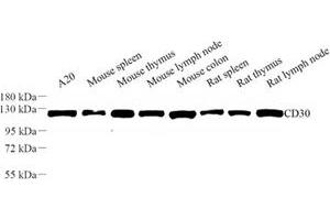 Western blot analysis of CD30 (ABIN7076072) at dilution of 1: 500