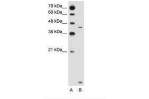 Image no. 2 for anti-Solute Carrier Family 46, Member 3 (SLC46A3) (N-Term) antibody (ABIN205029) (SLC46A3 抗体  (N-Term))