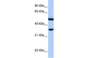Western Blotting (WB) image for anti-DnaJ (Hsp40) Homolog, Subfamily B, Member 6 (DNAJB6) antibody (ABIN2459535) (DNAJB6 抗体)