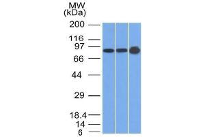 Western Blot of U87, HeLa and A431 cell lysates using Plakophilin-1 Mouse Monoclonal Antibody (10B2) (Plakophilin 1 抗体  (N-Term))