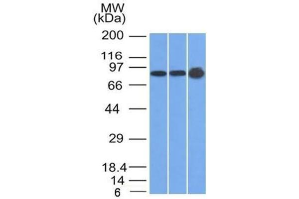 Plakophilin 1 抗体  (N-Term)