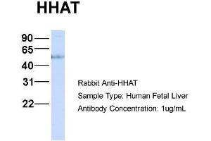 Host:  Rabbit  Target Name:  HHAT  Sample Type:  Human Fetal Liver  Antibody Dilution:  1. (HHAT 抗体  (N-Term))