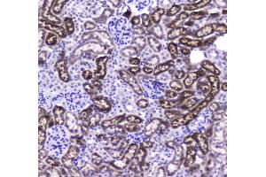 IHC analysis of CES1 using anti-CES1 antibody . (CES1 抗体  (AA 99-206))