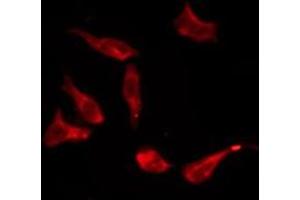 ABIN6276193 staining HT29 by IF/ICC. (OR8S1 抗体  (Internal Region))