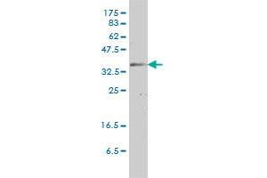 GJB3 monoclonal antibody (M01), clone 3B4-1B3 Western Blot analysis of GJB3 expression in HeLa . (Connexin 31 抗体  (AA 1-270))