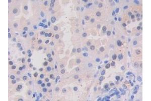 Detection of VAV3 in Human Kidney Tissue using Polyclonal Antibody to Vav 3 Oncogene (VAV3) (VAV3 抗体  (AA 398-583))