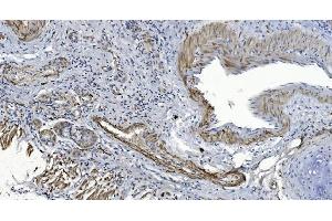IHC analysis of Alpha B Crystallin/CRYAB using anti-Alpha B Crystallin/CRYAB antibody (ABIN7601209).
