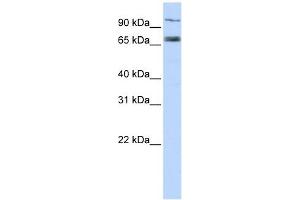 TAP1 antibody used at 1 ug/ml to detect target protein. (TAP1 抗体)