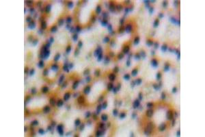 Used in DAB staining on fromalin fixed paraffin-embedded Kidney tissue (TGFB1I1 抗体  (AA 252-390))