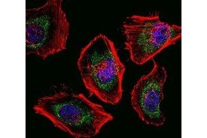 Fluorescent confocal image of HeLa cells stained with SOX4 antibody. (SOX4 抗体  (AA 86-114))