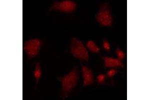 ABIN6275491 staining 293 by IF/ICC. (ARHGAP18 抗体  (Internal Region))