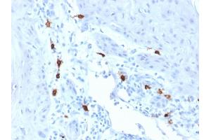 Formalin-fixed, paraffin-embedded human Skin stained with Tryptase Mouse Monoclonal Antibody (TPSAB1/1963). (TPSAB1 抗体  (AA 115-233))