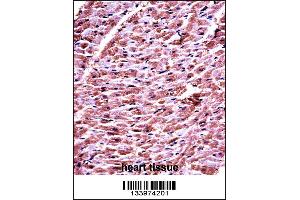 DHRS7C Antibody immunohistochemistry analysis in formalin fixed and paraffin embedded human heart tissue followed by peroxidase conjugation of the secondary antibody and DAB staining. (DHRS7C 抗体  (AA 116-145))