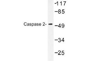 Image no. 1 for anti-Caspase 2, Apoptosis-Related Cysteine Peptidase (CASP2) antibody (ABIN317792) (Caspase 2 抗体)