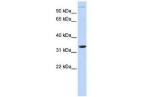 Image no. 1 for anti-Acidic (Leucine-Rich) Nuclear phosphoprotein 32 Family, Member B (ANP32B) (AA 36-85) antibody (ABIN6741124) (ANP32B 抗体  (AA 36-85))