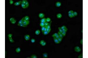 Immunofluorescence staining of HepG2 cells with ABIN7159581 at 1:100, counter-stained with DAPI. (METAP2 抗体  (AA 313-449))