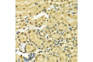 Immunohistochemistry of paraffin-embedded Mouse kidney using HNRNPA2B1 antibody at dilution of 1:100 (x400 lens).