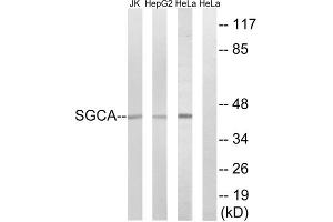 Western blot analysis of extracts from Jurkat cells, HepG2 cells and HeLa cells, using SGCA antibody. (SGCA 抗体  (Internal Region))