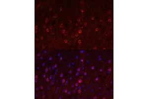 Immunofluorescence (IF) image for anti-Solute Carrier Family 1 (Neuronal/epithelial High Affinity Glutamate Transporter, System Xag), Member 1 (SLC1A1) (AA 430-524) antibody (ABIN6147868)