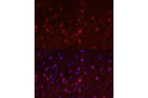 Immunofluorescence analysis of rat brain using SLC1 antibody (ABIN6131630, ABIN6147868, ABIN6147869 and ABIN6219899) at dilution of 1:100. (SLC1A1 抗体  (AA 430-524))