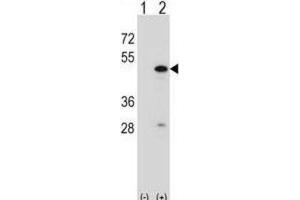 Western Blotting (WB) image for anti-RNA Binding Motif Protein 22 (RBM22) antibody (ABIN2998337)