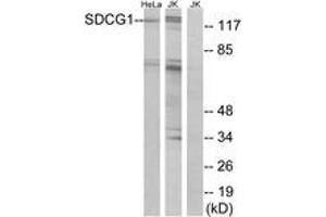 Western blot analysis of extracts from HeLa/Jurkat cells, using SDCG1 Antibody.