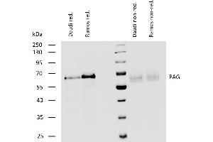 Western blotting analysis of human PAG using rabbit polyclonal antibody PAb (409) on lysates of Daudi and Ramos cell line under reducing and non-reducing conditions.