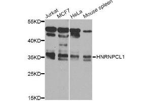 Western blot analysis of extracts of various cell lines, using HNRNPCL1 Antibody (ABIN5995850) at 1/1000 dilution. (HNRNPCL1 抗体)