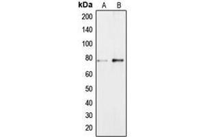 Western blot analysis of BRF1 expression in Jurkat (A), NIH3T3 (B) whole cell lysates. (BRF1 抗体  (Center))