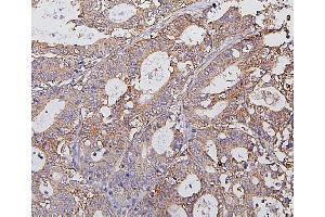 IHC analysis of Hexokinase 1/HK1 using anti-Hexokinase 1/HK1 antibody (ABIN7600260).