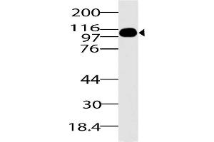 Image no. 1 for anti-DEAD (Asp-Glu-Ala-Asp) Box Polypeptide 58 (DDX58) (AA 1-220) antibody (ABIN5027274) (DDX58 抗体  (AA 1-220))