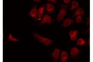 Immunofluorescence (fixed cells) (IF/ICC) image for anti-Solute Carrier Family 2 (Facilitated Glucose Transporter), Member 3 (SLC2A3) (C-Term) antibody (ABIN6261998)