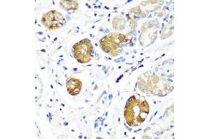 Immunohistochemistry of paraffin-embedded human stomach using SGSH antibody at dilution of 1:100 (40x lens). (SGSH 抗体)