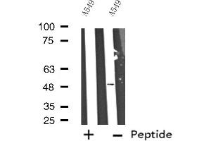 Western blot analysis of extracts from A549 cells, using Cytochrome P450 17A1 antibody. (CYP17A1 抗体  (Internal Region))