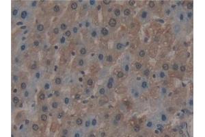 Detection of MX1 in Rat Liver Tissue using Polyclonal Antibody to Myxovirus Resistance 1 (MX1) (MX1 抗体  (AA 68-303))