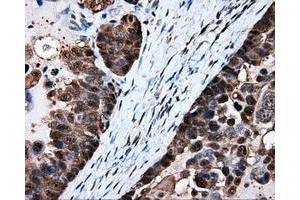 Immunohistochemical staining of paraffin-embedded Kidney tissue using anti-HSPA1A mouse monoclonal antibody. (HSP70 1A 抗体)
