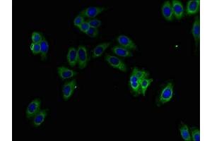 Immunofluorescent analysis of HepG2 cells using ABIN7157756 at dilution of 1:100 and Alexa Fluor 488-congugated AffiniPure Goat Anti-Rabbit IgG(H+L) (KMO 抗体  (AA 1-486))
