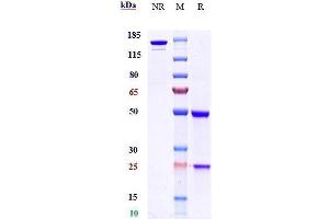 Anti-BTN3A1 Reference Antibody (CTX-2026) on SDS-PAGE under reducing (R) condition. (Recombinant BTN3A1 抗体)