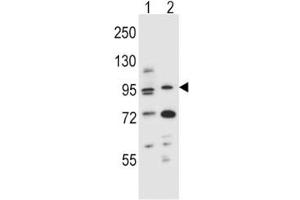 Western Blotting (WB) image for anti-Aryl Hydrocarbon Receptor (AHR) (AA 555-582) antibody (ABIN3030025)