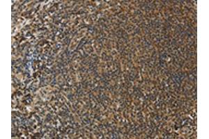 The image on the left is immunohistochemistry of paraffin-embedded Human tonsil tissue using ABIN7130557(PCP4 Antibody) at dilution 1/50, on the right is treated with fusion protein. (PCP4 抗体)