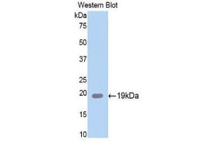 Western Blotting (WB) image for anti-serpin Peptidase Inhibitor, Clade A (Alpha-1 Antiproteinase, Antitrypsin), Member 6 (SERPINA6) (AA 106-255) antibody (ABIN1858273) (SERPINA6 抗体  (AA 106-255))