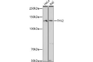 Western blot analysis of extracts of various cell lines, using TYK2 antibody (ABIN3022987, ABIN3022988, ABIN3022989 and ABIN6219333) at 1:500 dilution. (TYK2 抗体  (AA 750-850))