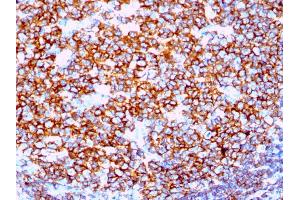 Formalin-fixed, paraffin-embedded human Tonsil stained with CD20 Rabbit Recombinant Monoclonal Antibody (IGEL/1497R). (Recombinant CD20 抗体)