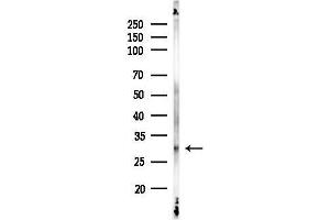 Western blot analysis of lysates from Rat liver, using NQO2 Antibody at 1/1000 dilution.