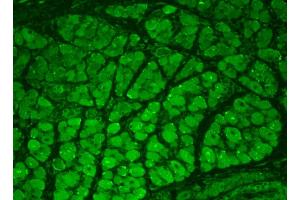 Immunohistochemistry analysis using Mouse Anti-CaMKII Monoclonal Antibody, Clone 22B1 . (CAMKII gamma 抗体  (Atto 488))