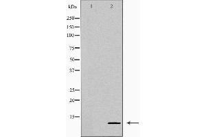 Western blot analysis of extracts of HeLa, using CXCL10 antibody.