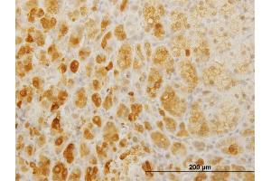 Immunoperoxidase of monoclonal antibody to TWIST2 on formalin-fixed paraffin-embedded human adrenal gland. (TWIST2 抗体  (AA 1-160))