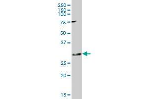 KCNIP2 MaxPab polyclonal antibody. (KCNIP2 抗体  (AA 1-270))